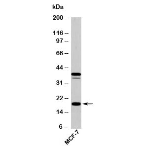 Western blot testing of human samples with AGR2 antibody at 5ug/ml. Expected molecular weight: 17-20