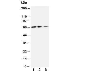 Western blot testing of CX3CL1 antibody and Lane 1: recombinant mouse protein 10ng; 2: 5ng; 3: 2.5ng