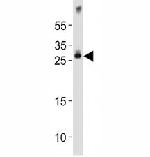 Olig1 Antibody
