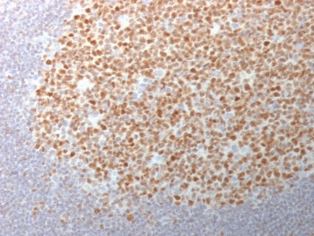 IHC testing of FFPE human tonsil tissue with Bcl6 antibody (clone BCL6/1982). Required HIER: boil ti