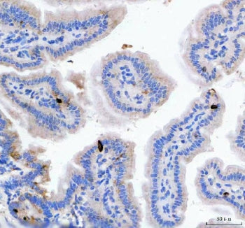 Gip Antibody / Gastric inhibitory polypeptide