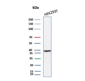 Western blot testing of human HEK293 cell lysate with AKR1B1 antibody (clone rAKR1B1/7295). Predicted molecular weight ~36 kDa.