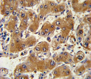 Collagen VI Antibody / COL6A1