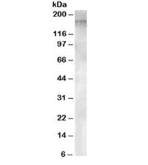 Western blot testing of human testis lysate with APA antibody at 1ug/ml. Predicted molecular weight 