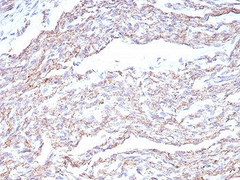 N-Cadherin Antibody / CDH2