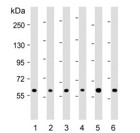 Western blot testing of human 1) 293T, 2) CCRF-CEM, 3) HeLa, 4) Jurkat, 5) MDA-MB-453 and 6) MCF7 ce