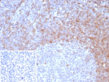 IHC staining of FFPE human tonsil tissue with IgD antibody (clone IGHD/8326R). Inset: PBS used in pl