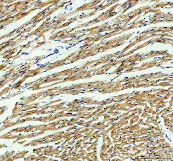 IHC staining of FFPE mouse heart tissue with IDH2 antibody. HIER: boil tissue sections in pH8 EDTA f