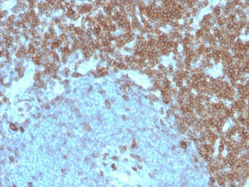 IHC staining of FFPE human tonsil with CD27 antibody (clone LPFS2/4179). HIER: boil tissue sections 