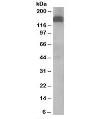 Western blot testing of human testis lysate with Dynactin antibody at 1ug/ml. Expected molecular wei