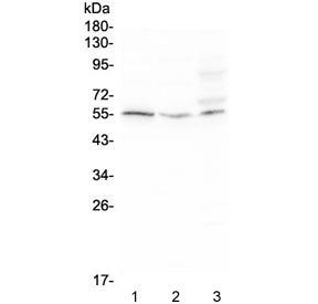 Western blot testing of human 1) Raji, 2) HeLa, and 3) SW620 cell lysate with D6 antibody at 0.5ug/m