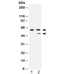 Carboxypeptidase B2 Antibody / CPB2 / TAFI