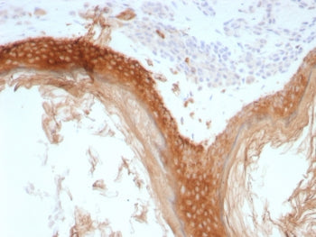 IHC staining of FFPE human skin tissue with recombinant Basic Cytokeratin antibody (clone rKRTH/8883
