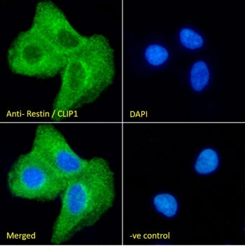 Immunofluorescent staining of fixed and permeabilized human A549 cells with CLIP antibody (green) at 10ug/ml and DAPI nuclear stain (blue).
