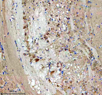 IHC staining of FFPE zebrafish brain tissue with Zebrafish Eif4a1 antibody. HIER: boil tissue sectio