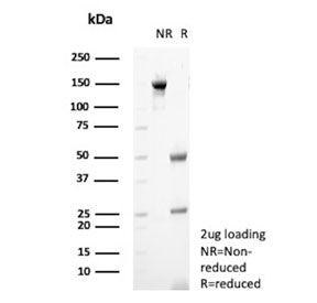 SDS-PAGE analysis of purified, BSA-free GnRH-Receptor antibody (clone A9E4) as confirmation of integ