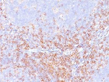 CD4 Antibody