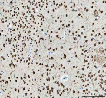 IHC staining of FFPE mouse brain tissue with NOVA1 antibody. HIER: boil tissue sections in pH8 EDTA 