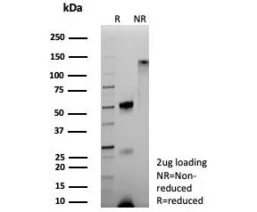 SDS-PAGE analysis of purified, BSA-free recombinant Hemoglobin alpha antibody (clone HBA/9193R) as c