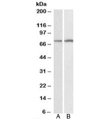 Western blot testing of HepG2 [A] and K562 [B] lysates with CYP2B6 antibody at 0.1ug/ml. Predicted m