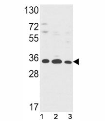Western blot analysis of Annexin V antibody and (1) HepG2, (2) A2058, (3) T47D lysate. Predicted mol