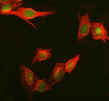 Immunofluorescent staining of FFPE human U-2 OS cells with Daxx antibody (green) and Beta Tubulin mA