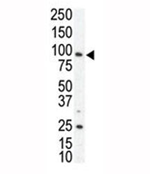 Western blot analysis of AXL antibody and SKBR3 cell lysate. Predicted molecular weight is 104 kDa u
