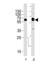 Western blot analysis of lysate from (1) SW480 and (2) U-87 MG cell line using TH antibody at 1:1000