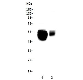 Western blot testing of 1) rat liver and 2) mouse liver lysate with SLC10A1 antibody. Expected molec