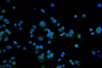 Immunofluorescent staining of FFPE human T-47D cells with TRPV1 antibody (green) and DAPI nuclear st