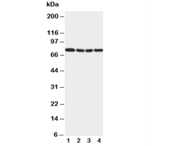 Western blot testing of IRAK1 antibody and Lane 1: rat liver; 2: human placenta; 3: MCF-7; 4: PANC c