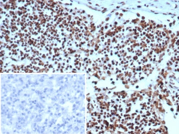 IHC staining of FFPE human lymph node tissue with XRCC5 / Ku86 / Ku80 antibody (clone XRCC5/7314). I