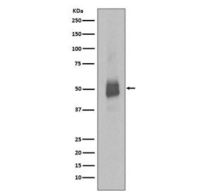 Western blot testing of lysate from human Jurkat cells treated with Pervanadate, with phospho-Lyn an