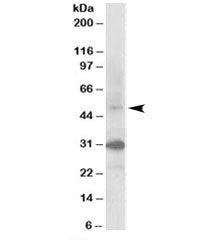 Western blot testing of human kidney lysate with FBXW2 antibody at 0.3ug/ml. Predicted molecular wei