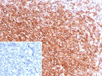 IHC staining of FFPE human tonsil tissue with CXCR5 antibody (clone CXCR5/8146R). Inset: PBS used in