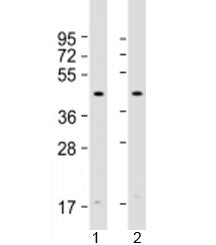 Western blot testing of human 1) HeLa and 2) Jurkat cell lysate with Atrogin 1 antibody at 1:2000. P
