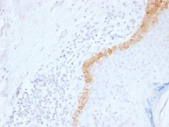 IHC testing of FFPE human skin with Keratin 15 antibody (clone LHK15). Required HIER: boil tissue se