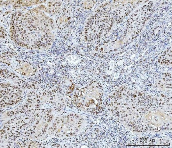 FEN1 Antibody / Flap endonuclease 1