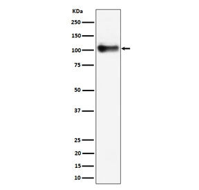 Thrombomodulin Antibody / CD141