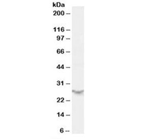 Western blot testing of human spleen lysate with PSME2 antibody at 0.5ug/ml. Predicted molecular wei