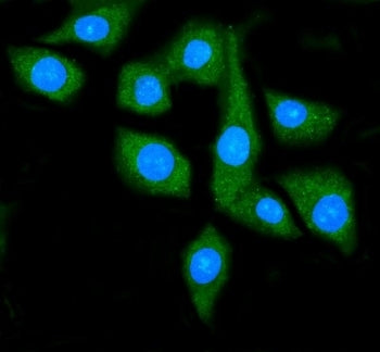 HSP90 alpha Antibody / HSP90AA1