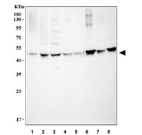 Western blot testing of 1) human A431, 2) human SK-N-SH, 3) human HeLa, 4) rat lung, 5) rat kidney, 