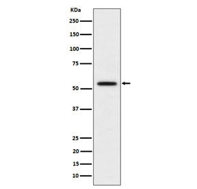 Western blot testing of human Hela cell lysate with KATNA1 antibody. Predicted molecular weight ~56 