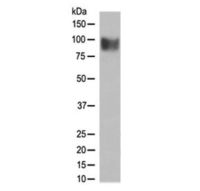 Western blot testing of human SH-SY5Y cell lysate with IFNAR1 antibody at 0.5ug/ml. Expected molecul
