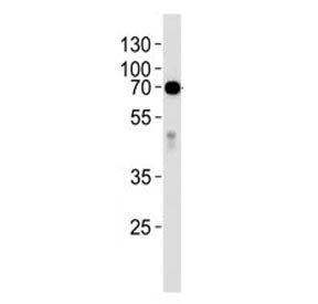 Western blot analysis of lysate from human placenta tissue lysate using anti-Alkaline Phosphatase an