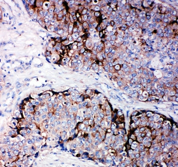 TIMP2 Antibody