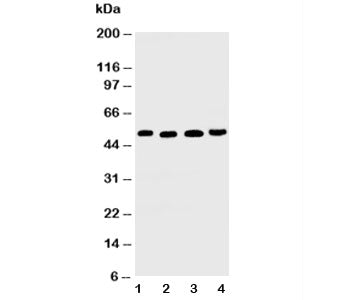 Western blot testing of TRAIL R2 antibody and Lane 1: HeLa; 2: MM231; 3: SGC; 4: HT1080 cell lysate