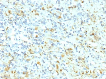 ALK Antibody / Anaplastic Lymphoma Kinase
