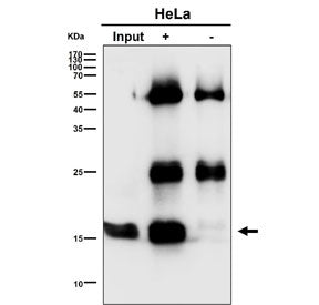 Immunoprecipitation of UBE2D1 protein from 500ug of human HeLa whole cell lysate using UBE2D1 antibo
