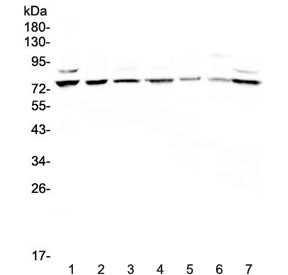 Western blot testing of human 1) HeLa, 2) COLO320, 3) A549, 4) PANC-1, 5) A431, 6) Jurkat and 7) 293